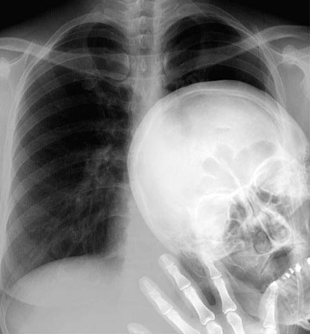 Tags: funny, peekaboo, photobomber, Photoshopped, xray